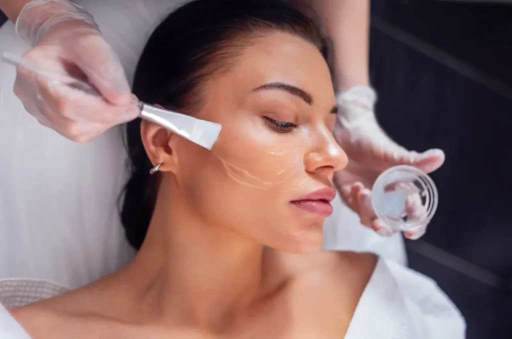 Dark chemical peel