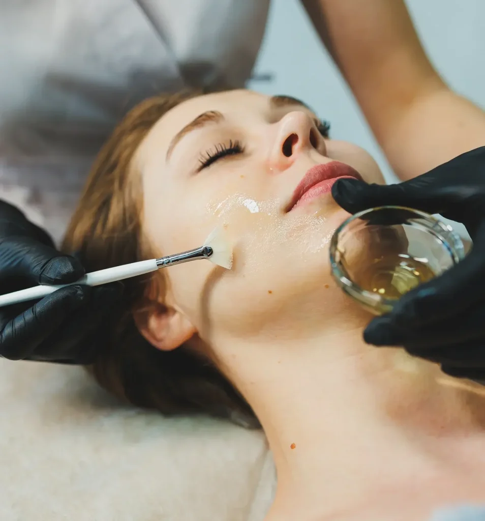 Chemical peel near me