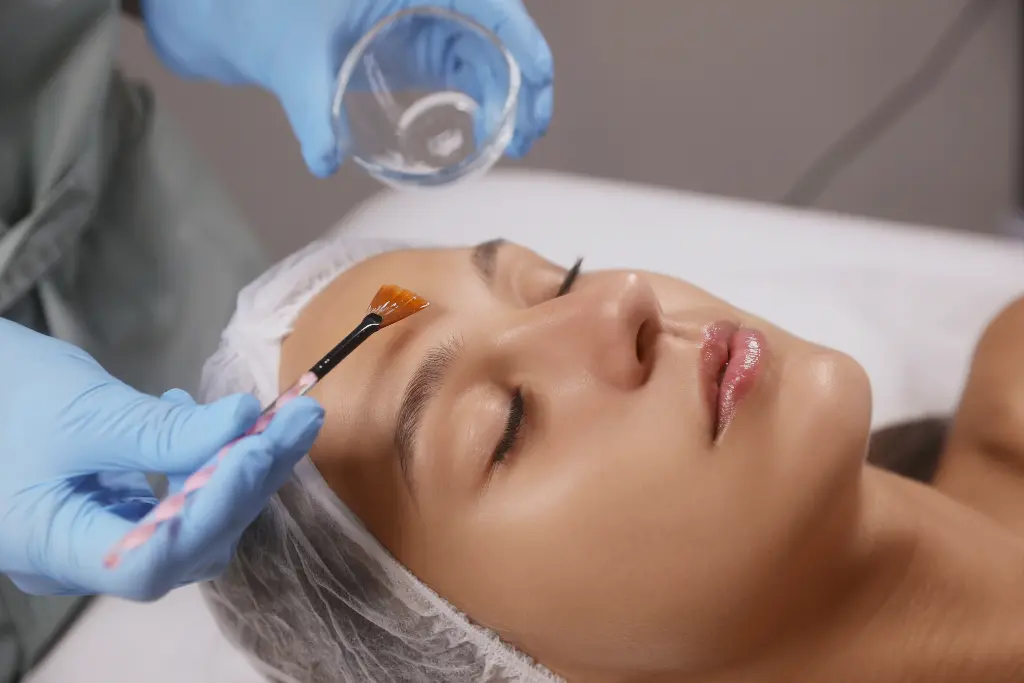 Chemical peels