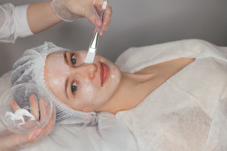 Chemical peel