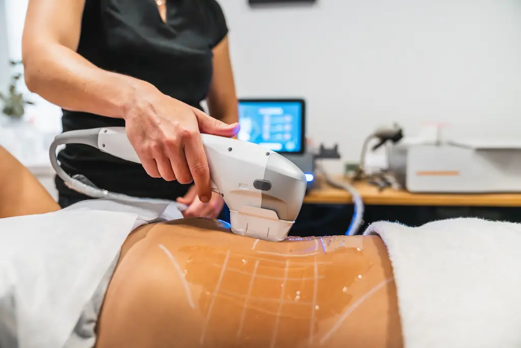 Hifu body contouring & slimming treatment